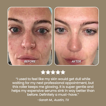 SkinNeedlePro™ Derma Roller for In-Between Microneedling